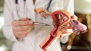 Menopausa precoce: sintomas, causas e quando fazer reposição hormonal